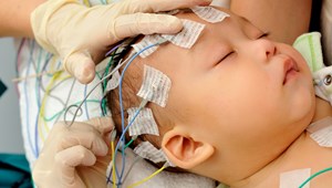EEG nodes on baby