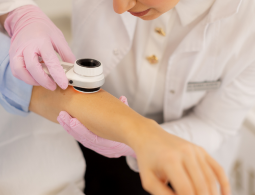 People of all ages diagnosed with morphea to take part in research study